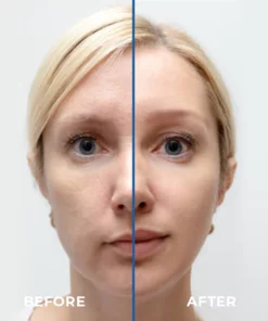 BeautyMAX™ V-Face Lifting Tape