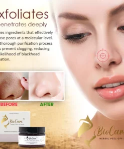 BioCare™ Herbal Peel-Off Mask