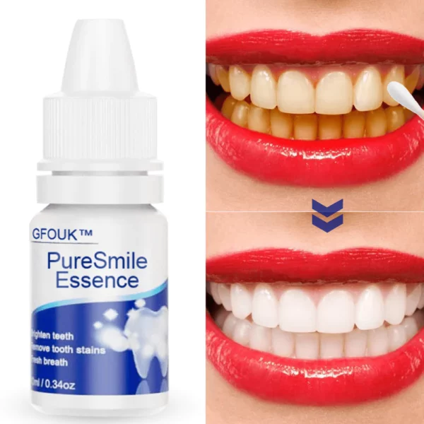 GFOUK™️ PureSmile Essence