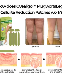 Oveallgo™ MugwortsLegs FIRM Cellulite Reduction Patches