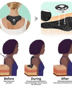 Oveallgo™ TENSWave Acupoints LymphoSoothe NeckInstrument