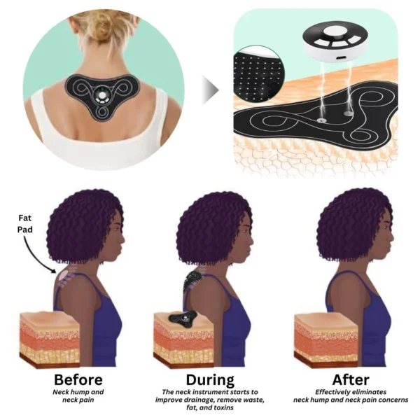 Oveallgo™ TENSWave Acupoints LymphoSoothe NeckInstrument