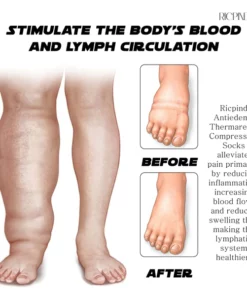 RICPIND AntiEdema ThermaRelax Compression Socks