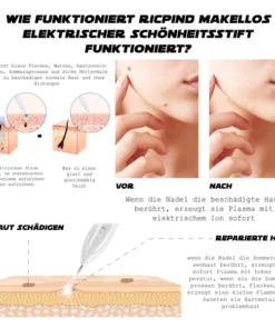 Ricpind Fleckfrei ZuhauseProfessionell Elektrisch Schönheitsstift