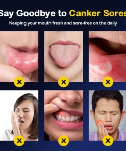 SOUTH MOON™ Canker Sores Spray