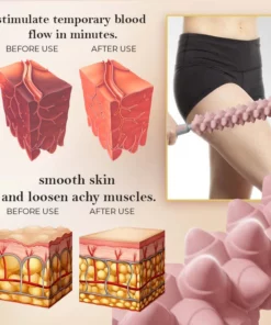 SculptiWave™ Fascia Cellulite Blaster