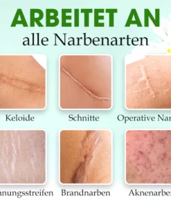 SkinFix™ Narbenreparatur-Essenz