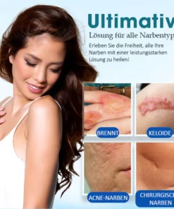 SkinPro™ Narbe Entfernungsgel