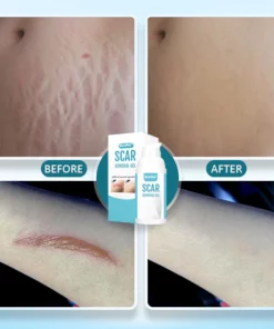 SkinPro™ Scar Removal Gel