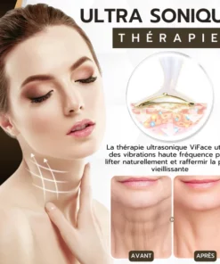 ViFace Lifting Facial Ultrasonique