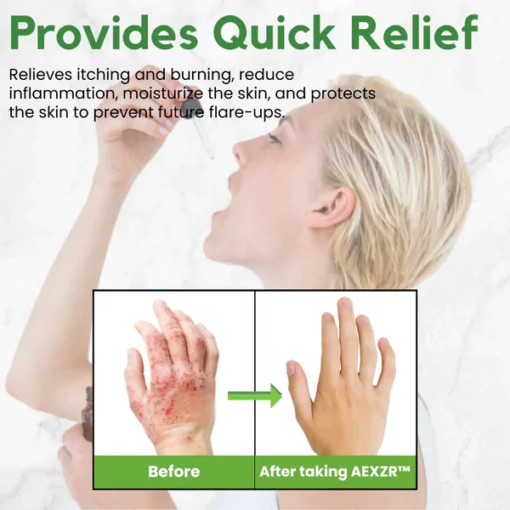 AEXZR™ Eczema Herbal Drops