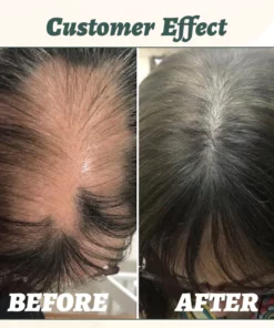 Ceoerty™ GingerEssence Hair Growth Serum