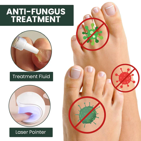 Oveallgo™ LifeMed Home Use Onychomycosis Fungal Laser Treatment