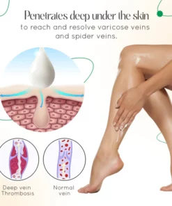 VascuClear™ Vein Therapy Cream