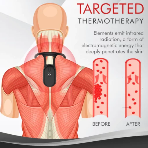 AEXZR™ Acupressure Thermal Neck Device