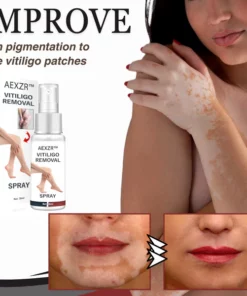 AEXZR™ Vitiligo Removal Spray