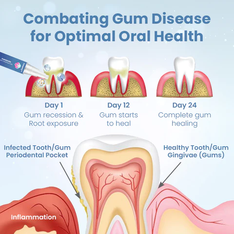 Ceoerty™ InstaSmile Gum Treatment Gel