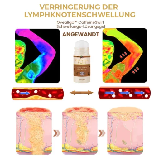 Fivfivgo™ CaffeineSwirl Schwellungs-Lösungsgel Plus