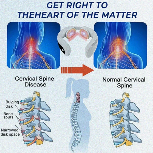 Fivfivgo™ NeckEase EMS Lymphatische Therapie Akupunktmassagegerät - Image 3