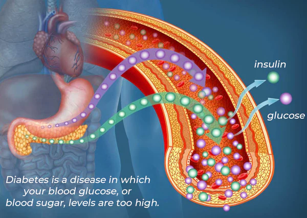 GFOUK ™SugarSync Health Control Aerosolizer