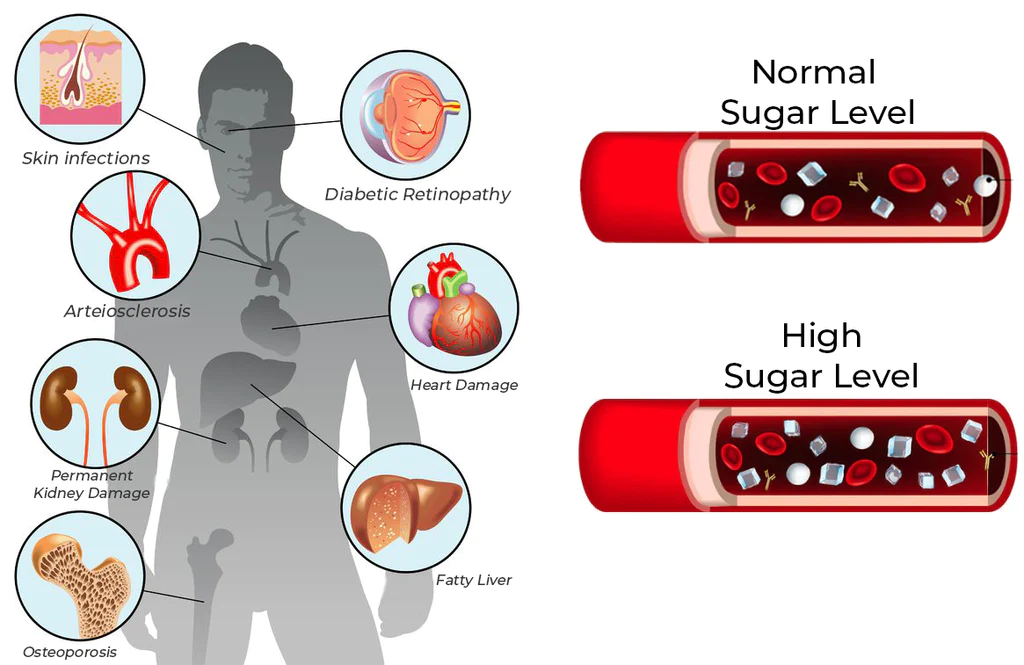 GFOUK ™SugarSync Health Control Aerosolizer