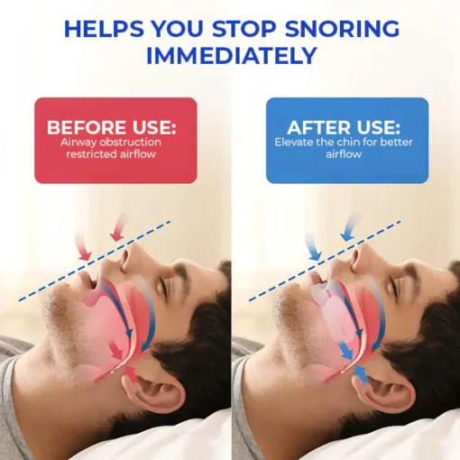 Oveallgo™ Adjustable Anti-snoring Device - Image 6