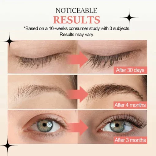 Oveallgo™ Advanced Eyelash Growth Serum - Image 4