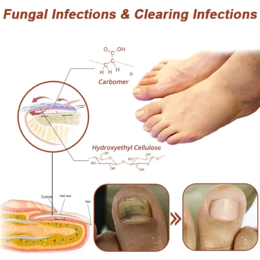 Oveallgo™ PROMAX Revolutionary High-Efficiency Light Therapy Device For Toenail Diseases - Image 2