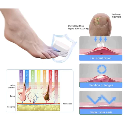 Oveallgo™ PROMAX Revolutionary High-Efficiency Light Therapy Device For Toenail Diseases - Image 3