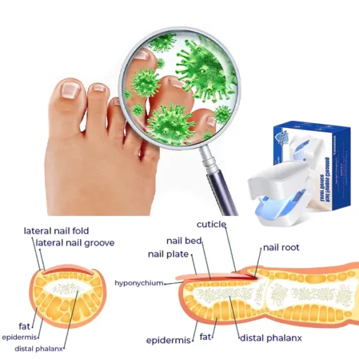 Oveallgo™ PROMAX Revolutionary High-Efficiency Light Therapy Device For Toenail Diseases - Image 4