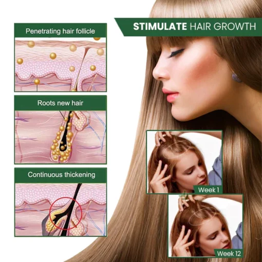 Oveallgo™ PROMAX ScalpRevive Minoxidil Growth Roller - Image 5