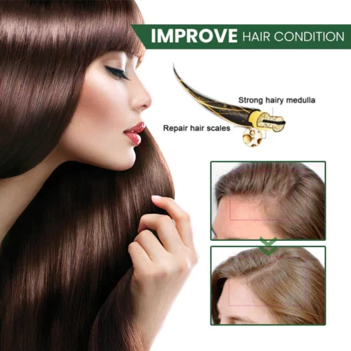 Oveallgo™ PROMAX ScalpRevive Minoxidil Growth Roller - Image 6