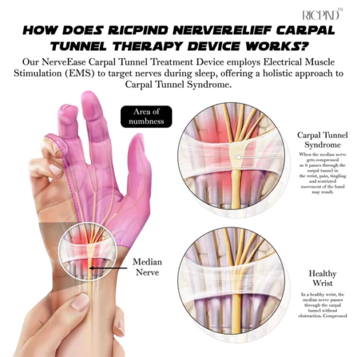 RICPIND NerveRelief Carpal Tunnel Therapy Device - Image 4