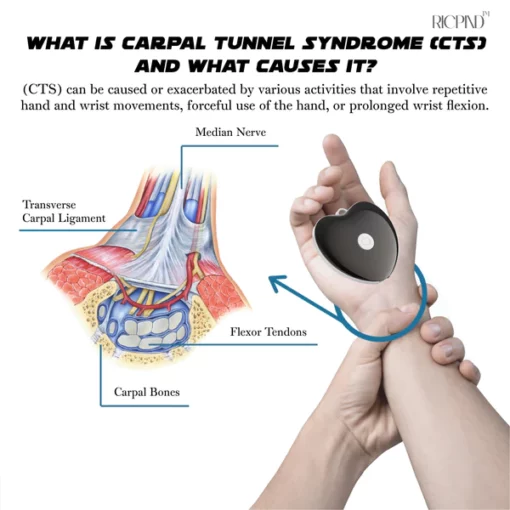 RICPIND NerveRelief Carpal Tunnel Therapy Device - Image 6