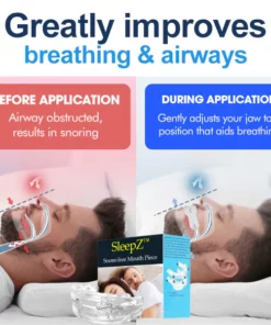 SleepZ™ Snore-free Mouth Piece