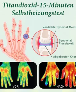 Sugoola™ Fern-Infrarot-Titan-Ionen-Arthritis-Therapie Wärme-Kompressionshandschuhe