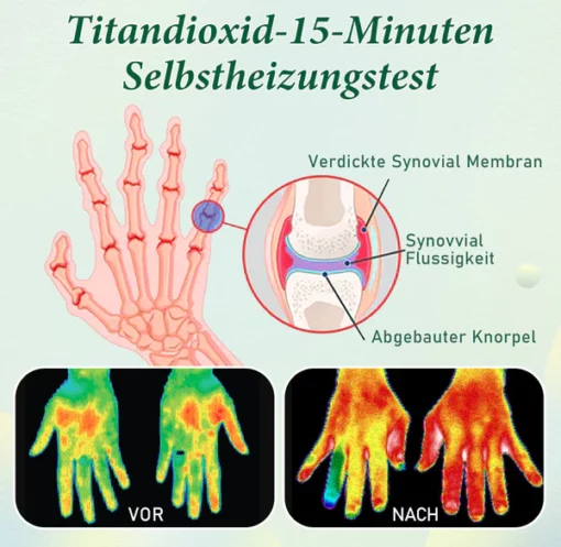 Sugoola™ Fern-Infrarot-Titan-Ionen-Arthritis-Therapie Wärme-Kompressionshandschuhe