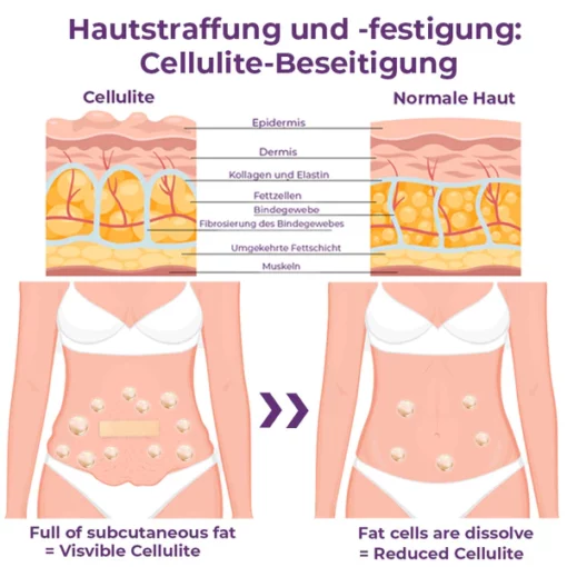 flysmus™ CelluFirmX Haut-Rebound Verstärkung Pflaster - Image 2