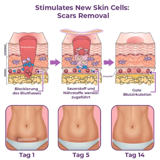 flysmus™ CelluFirmX Haut-Rebound Verstärkung Pflaster - Image 3