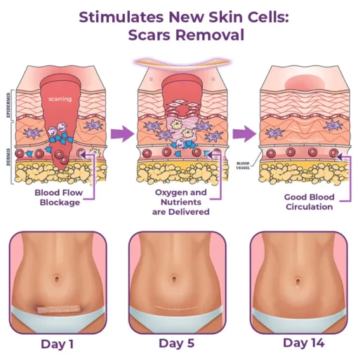 flysmus™ CelluFirmX Skin Rebound Boosting Patches - Image 3