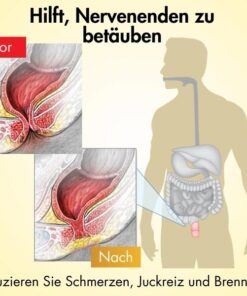 AEXZR™ Hämorrhoiden-Linderungscremewirksam