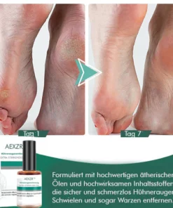 AEXZR™ Hühneraugenentfernung Extra Starkes Gel