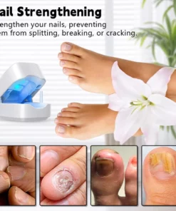 Biancat™ Nail Fungal Infection Repair Device