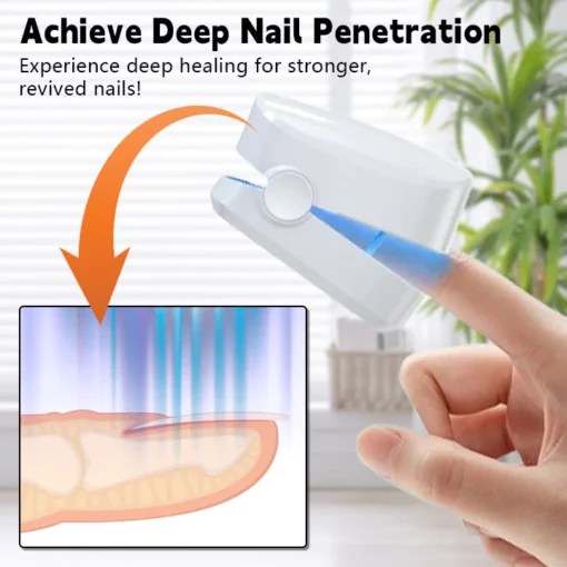 Biancat™ Nail Fungal Infection Repair Device