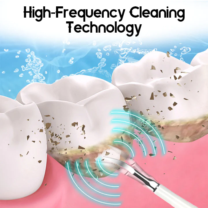 Ceoerty™ SonicSmile Ultrasonic Dental Cleanser