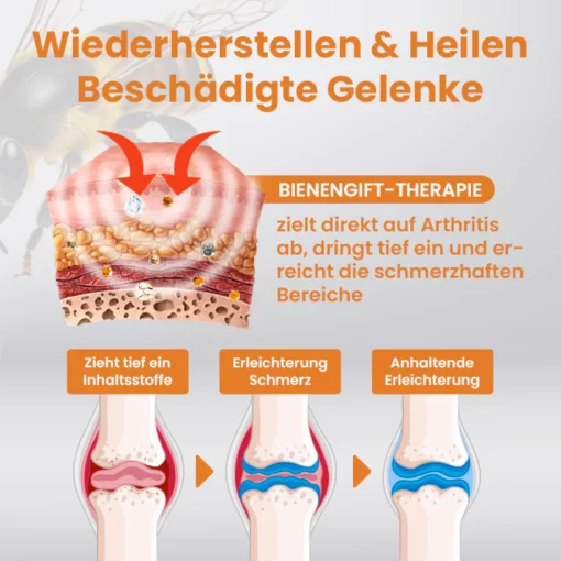 Ceoerty™ BoneNJoint Bienengift-Therapie-Spray