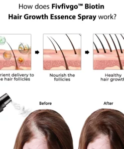 Fivfivgo™ Biotin Hair Growth Essence Spray