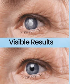 Fivfivgo™ Cataract and Glaucoma Mositurizing Eye Drops