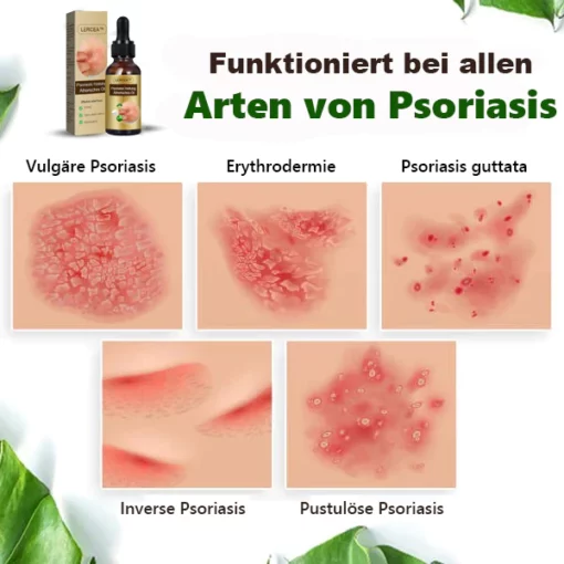 LERCEA™ Psoriasis Heilung Ätherisches Öl