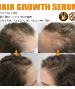 LIMETOW™ Biotin Hair Growth Agent